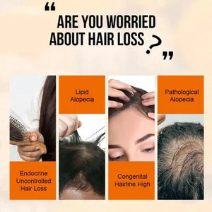 Hair Growth Essential Oil – Reclaim Your Luscious Locks!