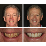 Load image into Gallery viewer, Teeth Whitening Essence
