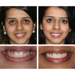 Load image into Gallery viewer, Teeth Whitening Essence

